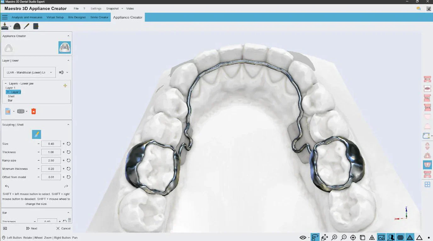 Deltaface Appliance Designer Software vs. Other Orthodontic Appliance Design Software