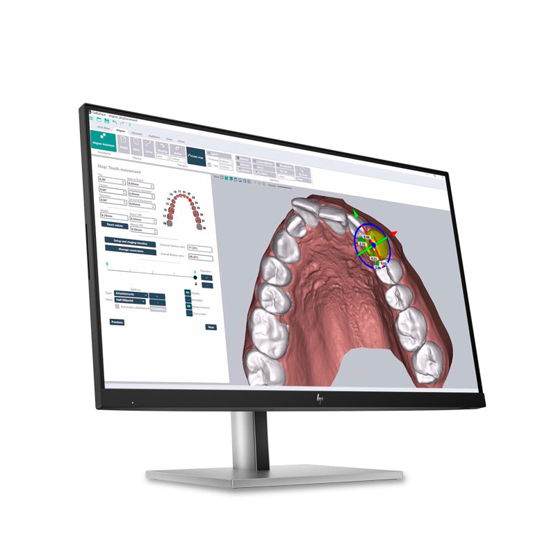Deltaface Aligner Software