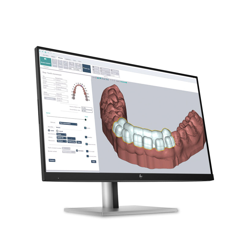 Deltaface Indirect Bonding Software