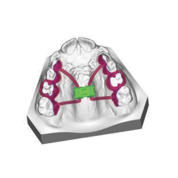 CAD-CAM Anatomical Expanders