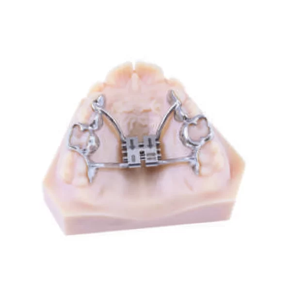 CAD-CAM Rapid Expander - Tooth Borne