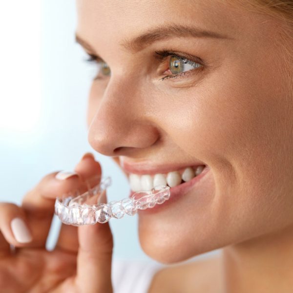 Direct Print Aligners from 3DNA Dental