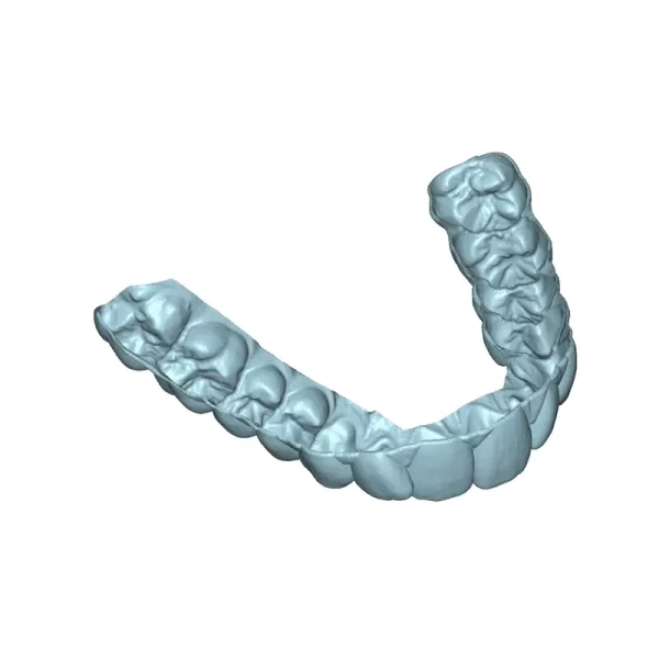 Deltaface Aligner Software