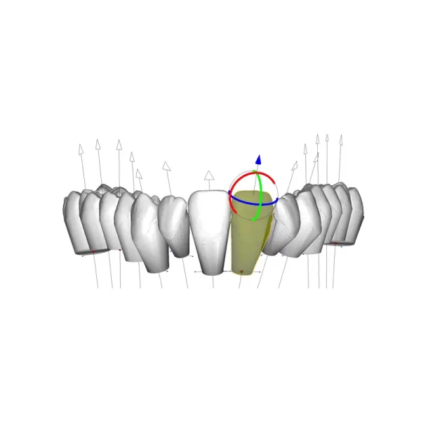 Deltaface Aligner Software