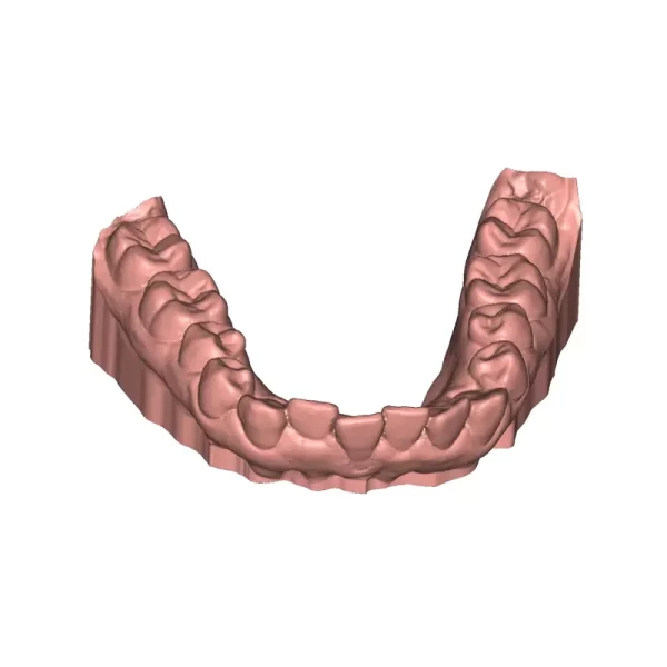 Deltaface Aligner Software