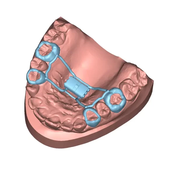 Deltaface Customized Appliance Software from 3DNA Dental