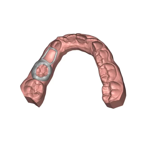 Deltaface Customized Appliance Software from 3DNA Dental