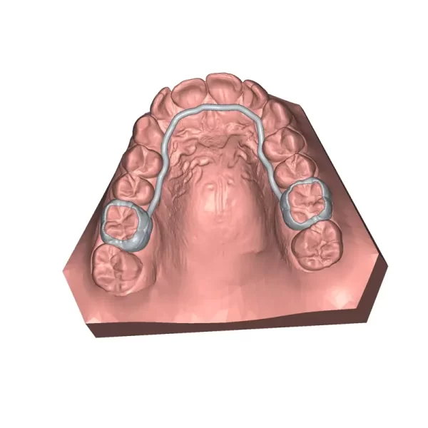 Deltaface Customized Appliance Software from 3DNA Dental