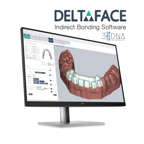 Deltaface Indirect Bonding Software