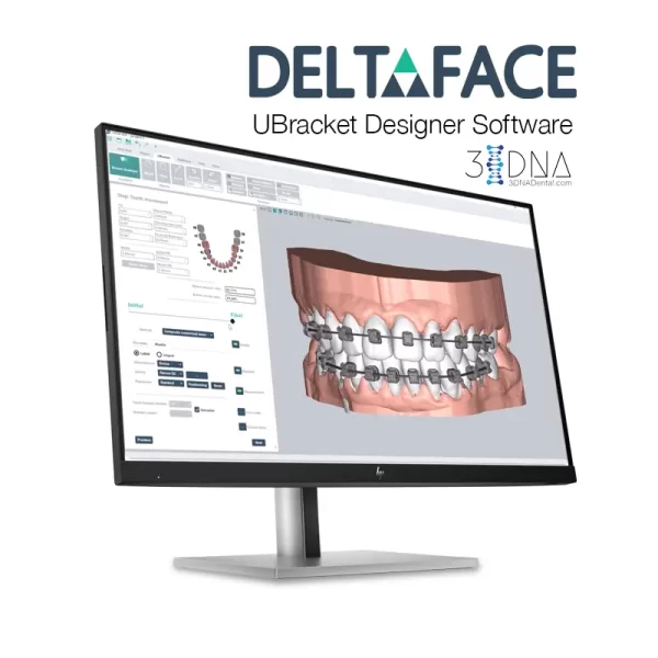 DeltaFace UBrackets Customized Brackets Software from 3DNA Dental