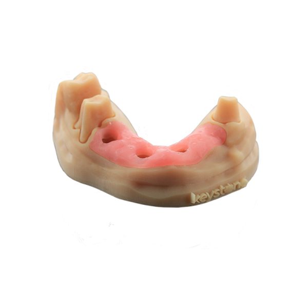 KeyMask Resin from 3DNA Dental