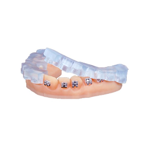 KeyOrtho IBT Resin from 3DNA Dental