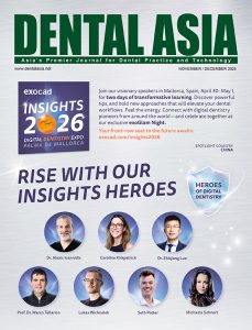 Active memory clear aligners illustrating orthodontic tooth movement concepts from “Beyond Brackets: Rethinking Tooth Movement with Active Memory Aligners” by Dr. Jean-Marc Retrouvey.