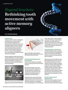 Active memory clear aligners illustrating orthodontic tooth movement concepts from “Beyond Brackets: Rethinking Tooth Movement with Active Memory Aligners” by Dr. Jean-Marc Retrouvey.